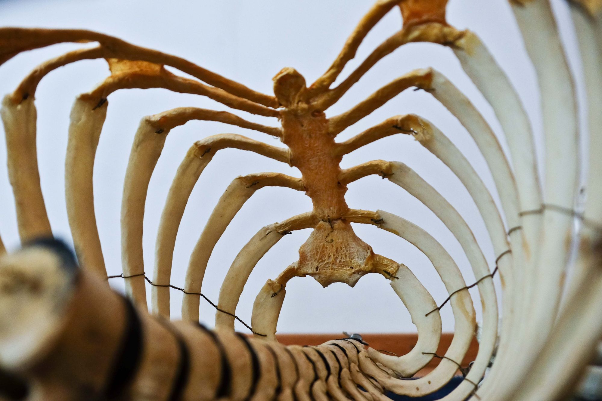 Bone Health Today for a Better Tomorrow